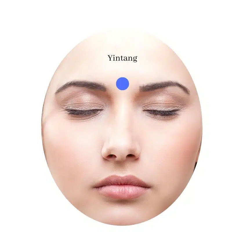 yintang